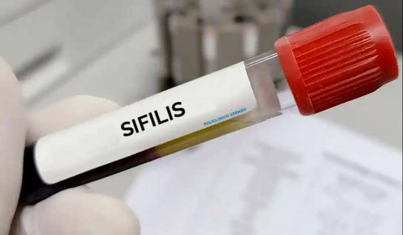 Alarmante aumento de casos de sfilis, VIH y tuberculosis
