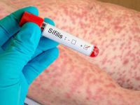 Advierten por el aumento sostenido de casos de s�filis, con foco en R�o Grande